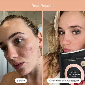 SKIN COLLAGEN+